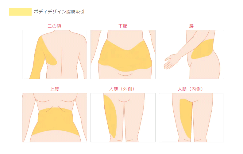 ボディデザインの脂肪吸引範囲